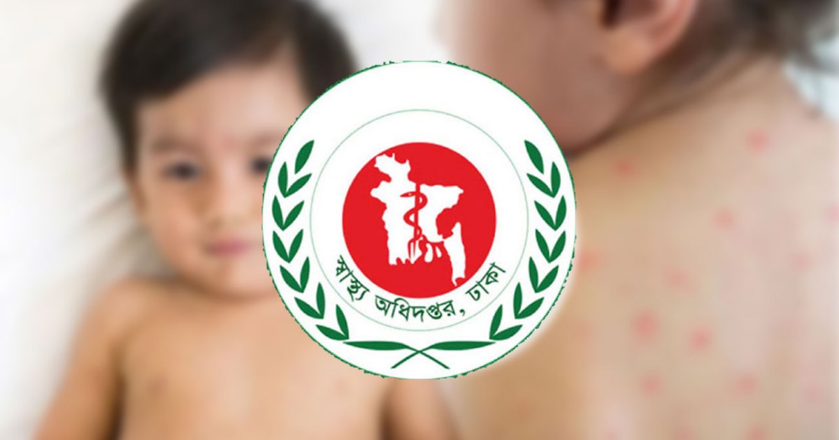 ২৪ ঘণ্টায় হাম ও উপসর্গে আরও ৭ শিশুর মৃত্যু