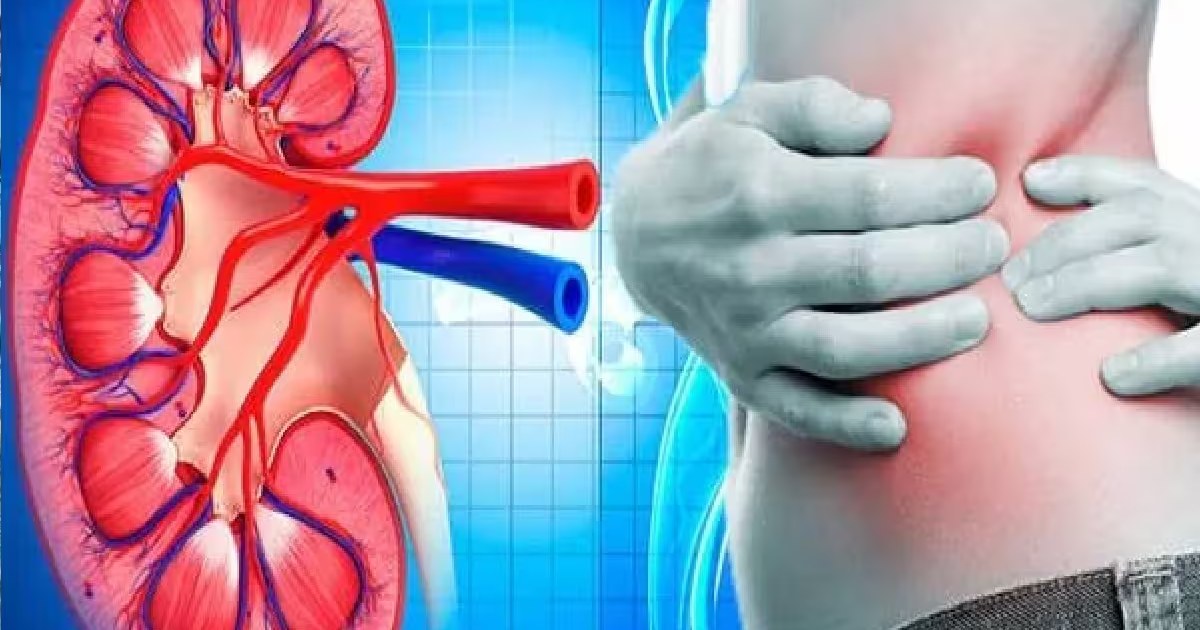 Home Kidney Function Test: A Simple 10-Hour Urine Measurement Guide