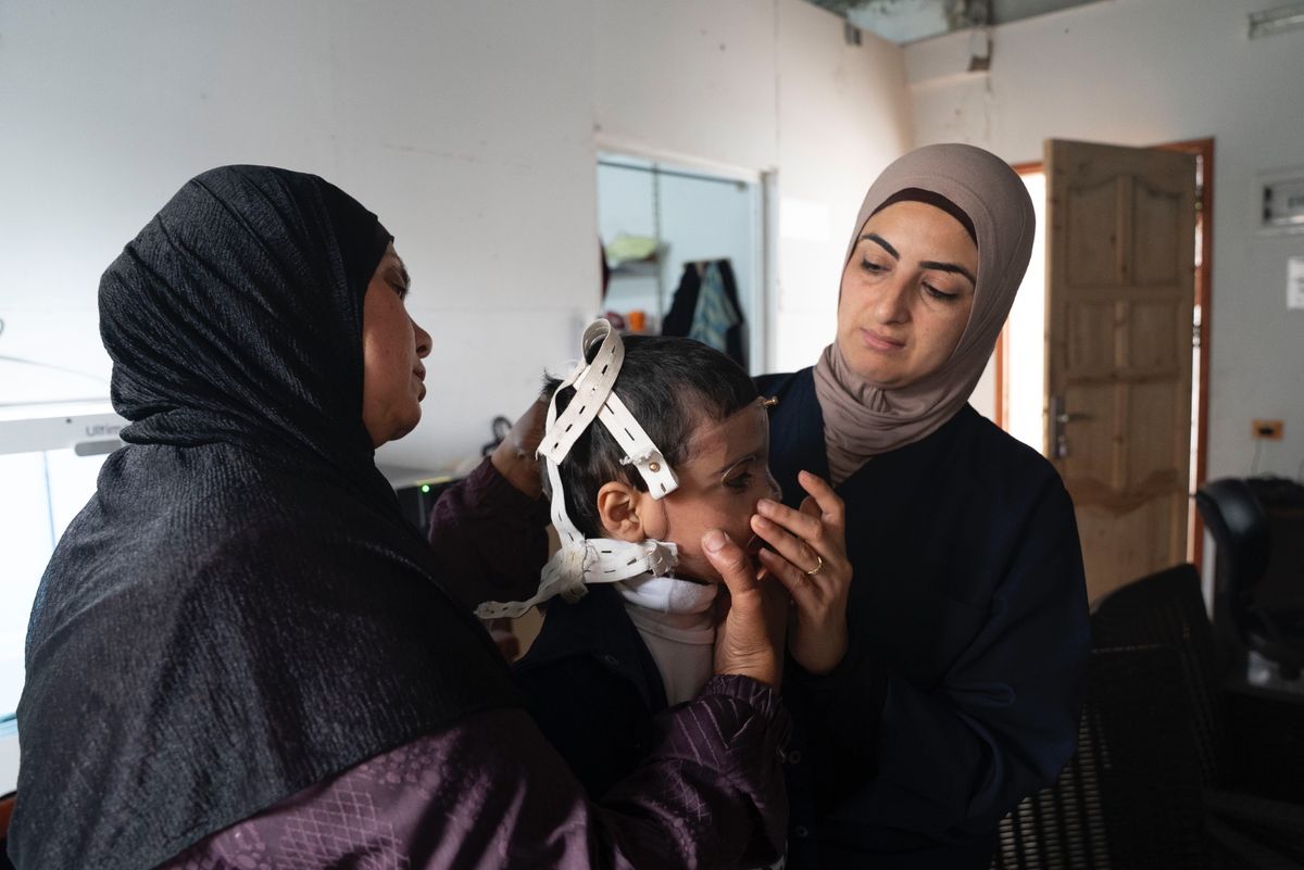 Gaza Burns Treatment Halts Due to Medical Supply Shortages