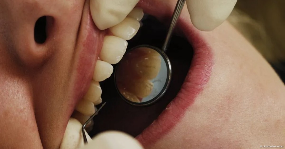 Australian Dentist Warning: Thousands at Risk of HIV and Hepatitis