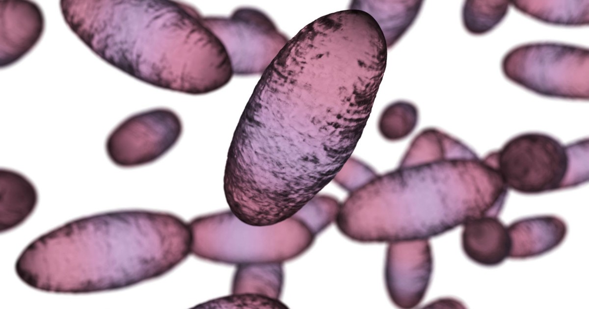US Monitoring Russia After Plague Lab Worker Dies
